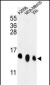 RPL36 Antibody (N-term)